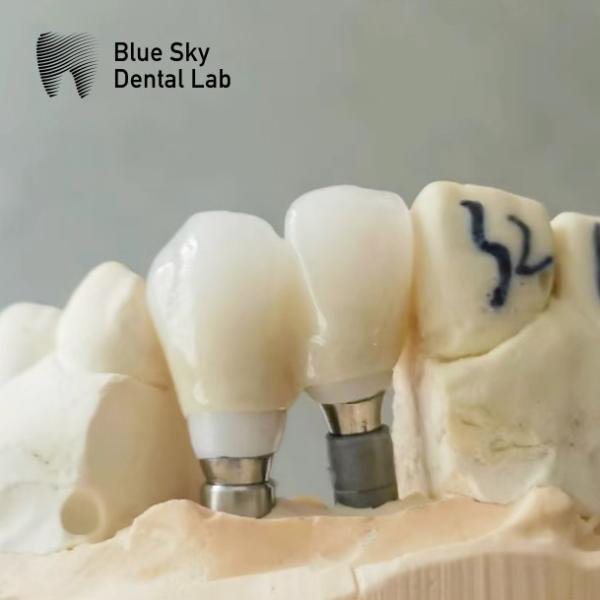 Single Crowns Zirconia Abutment Hypoallergenic Dental Implant Zirconia Abutment