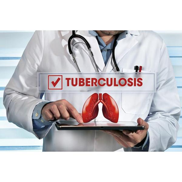 99% Specificity TB Antibody IgG IgM Tuberculosis Rapid Test Kit