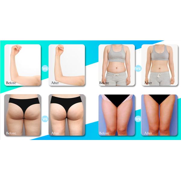 Portable Cavitation Vacuum Machine , Body Shaping Cavitation Vacuum Slimming Machine