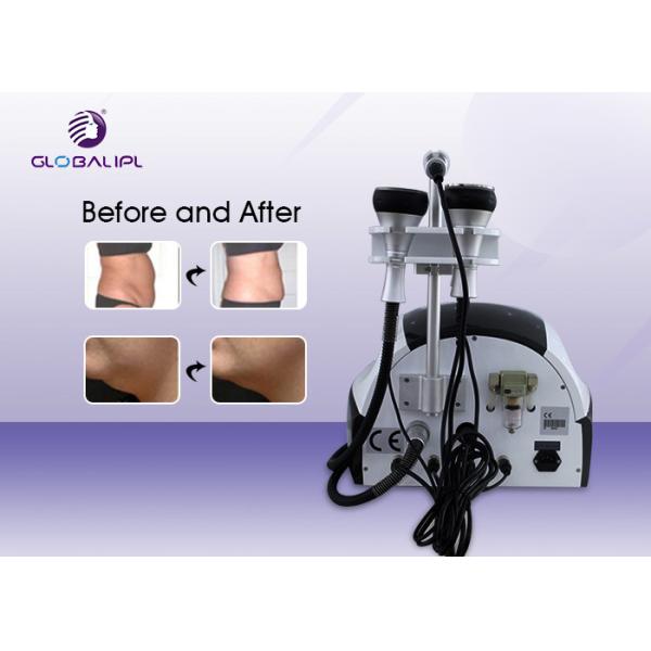 Ultrasonic Cavitation Slimming Machine / rf vacuum 5 in 1 cavitation body slimming machine