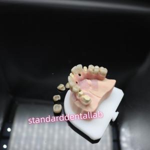 China Digital Dental Malo Implant Bridge Titanium Ivoclar Hybrid Zirconia Bridge wholesale