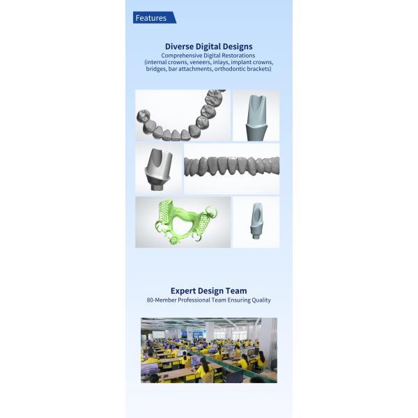 CAD CAM Dental Design Service AI Inlay Crown Upper Implant Crown