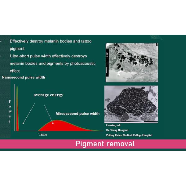 Pico Laser Machine 532nm 1064nm 755nm Q Switch Nd YAG Laser Equipment