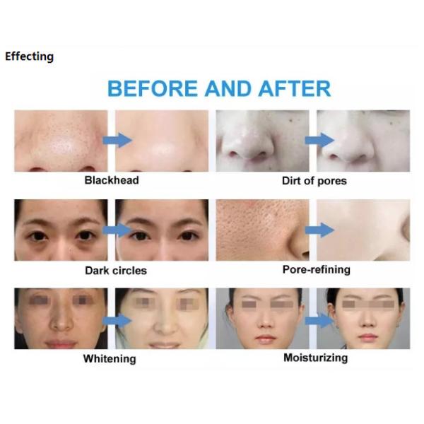 6 In 1 Photon Light Therapy Machine PDT Hydrafacial Care Beauty Device