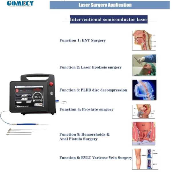 Wholesale 1470nm Lipolysis Lipo Laser Device Endolaser Liposuction Machine