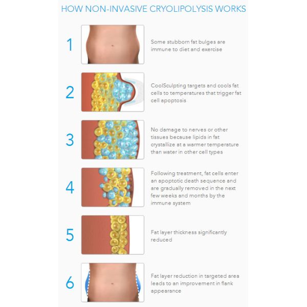 NUBWAY OEM 3 years warranty best result reduce 3-8cm Cryolipolysis Slimming Device