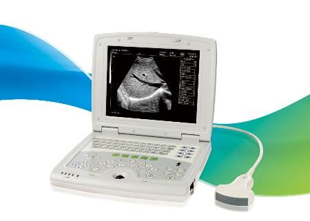 Mobile Ultrasound Machine Digital Laptop Ultrasound Scanner with 100 Frames Permanent Storage