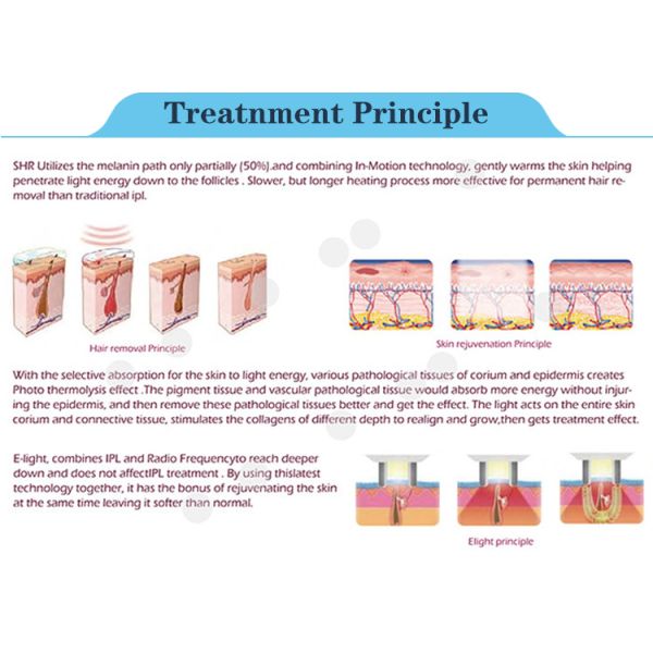 Factory price elight hair removal skin rejuvenation beauty salon equipment ipl shr with fda ce