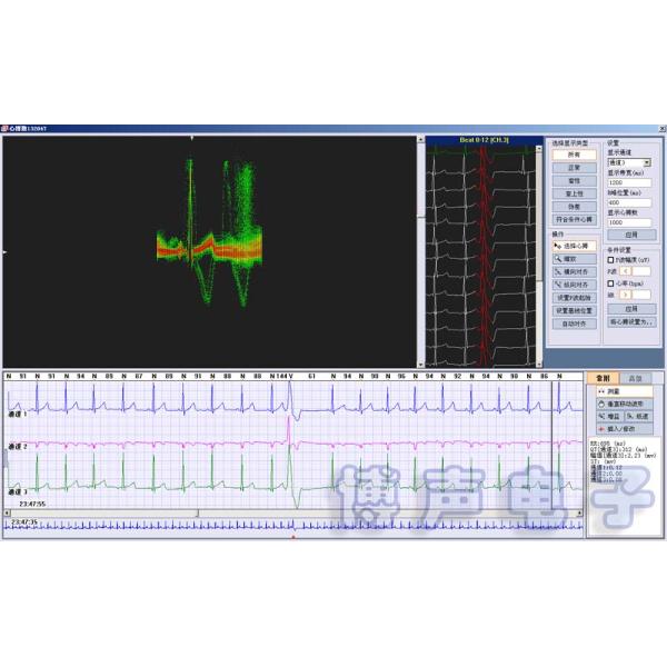 CE Approved 99.9% Accuracy Holter ECG Software 3/12 Channels 24-Hours Ambulatory ECG Holter Monitor