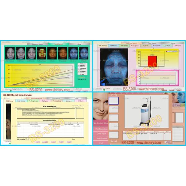 7200 K 3d Epidermal Skin Analysis Machine With English Version Software