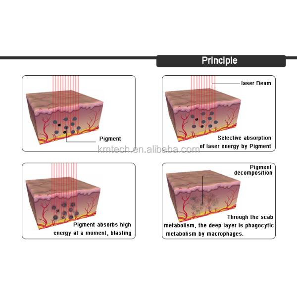 Pico Laser Machine 532nm 1064nm 755nm Q Switch Nd YAG Laser Equipment
