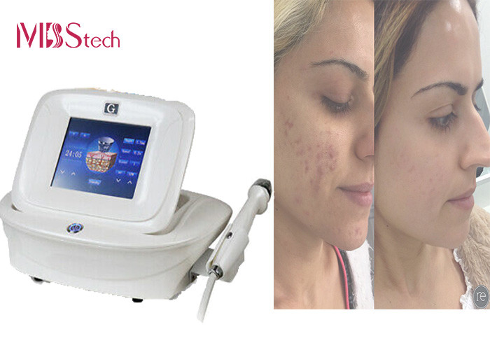 China Portable 4 Tips Removal Stretch Mark Microneedle RF Machine wholesale