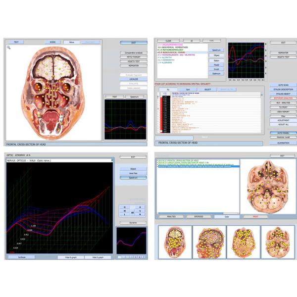 Spectrum Quantum 9d Nls Health Analyzer , Body Composition Analyser Machine