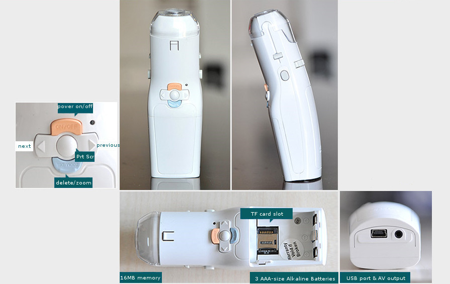China High Definition Echo - Digital Electronic Colposcope Gynaecologic Apparatus Colposcope wholesale