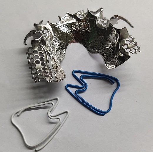 CAD Design Titanium Alloy Partial Denture Metal Framework