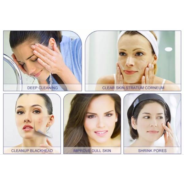 4 Tips Dermabrasion Diamond Peel Hydro Facial Machines