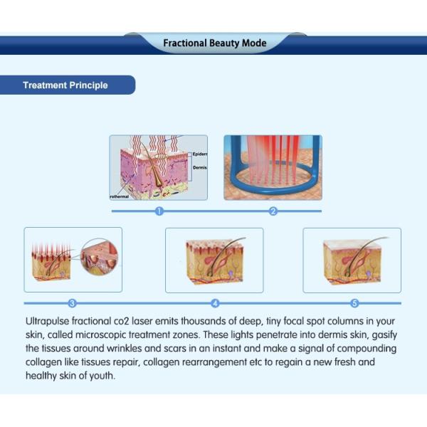 Femilift Pixel RF CO2 Fractional Laser Machine 1-10HZ Stationary Style