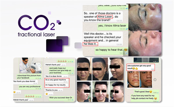 Salon Clinic 60W CO2 Fractional Laser Machine 10600nm