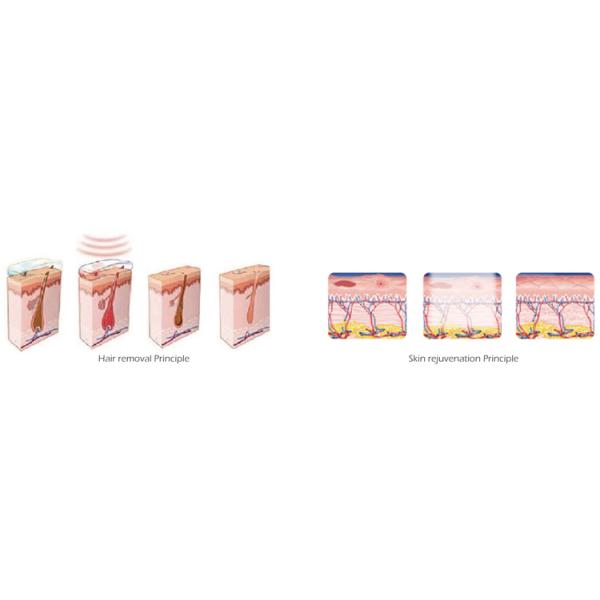 Forimi newest Multifunction 3 heads 1800w input power shr ipl e-light depilation machine for beauty clinic use