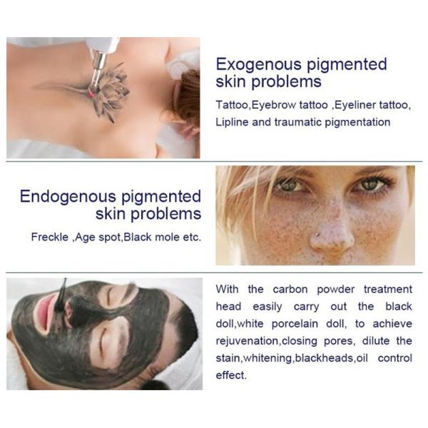 Portable Q Switch Nd Yag Laser Machine Pigment Removal