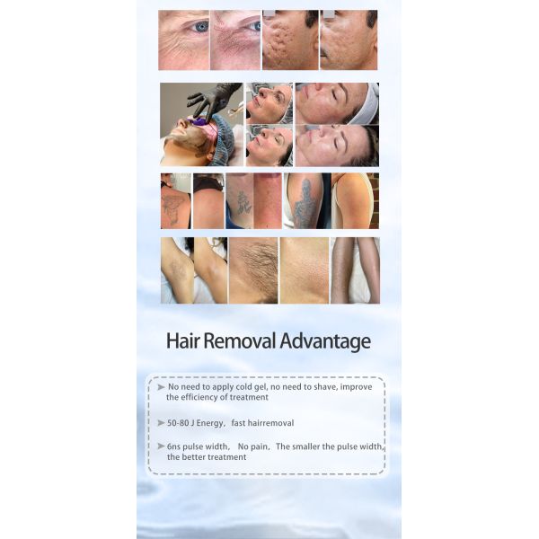 Stationary Style Pico Tattoo Removal Machine 3500W Skin Whitening Laser Machine