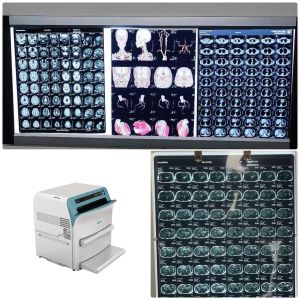 Buy cheap Low Fog Level Medical X Ray Blue Film 200±5μM High Sharpness from wholesalers