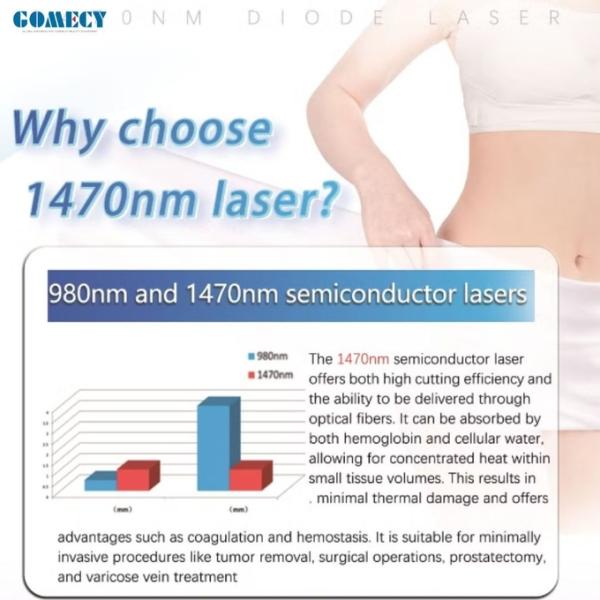 Wholesale 1470nm Lipolysis Lipo Laser Device Endolaser Liposuction Machine