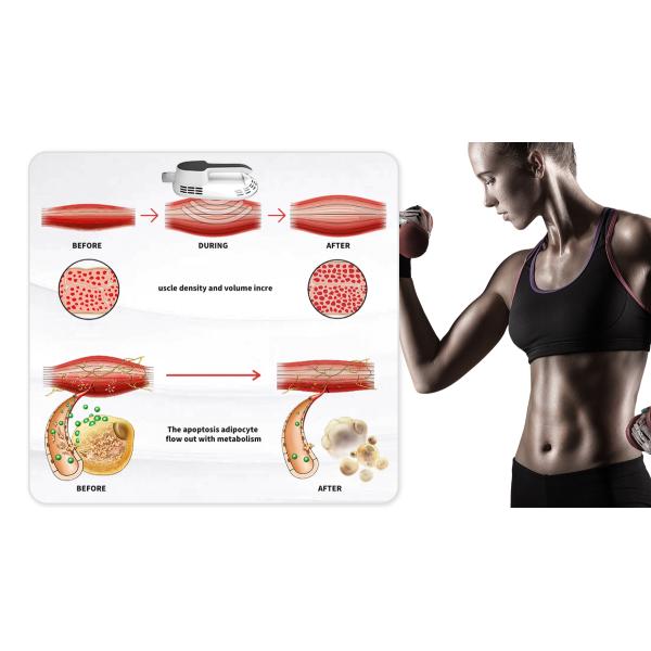 Ems Sculpting Machine 2 Handles Ems Body Sculpt Fat Removal Muscle Building EMS Shaping Slimming machine