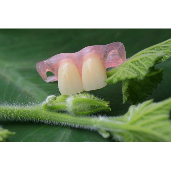 Temporary Soft And Elastic Valplast Invisible Denture