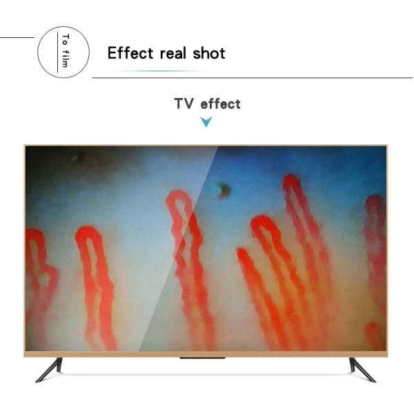 LCD Digital Biological Microscope Microcirculation Checking Capillary Microscope