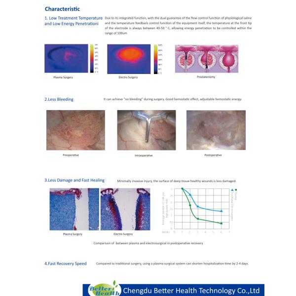 Single Loop Design BPH Surgery Plasma Probe Unmatched Performance for Resection