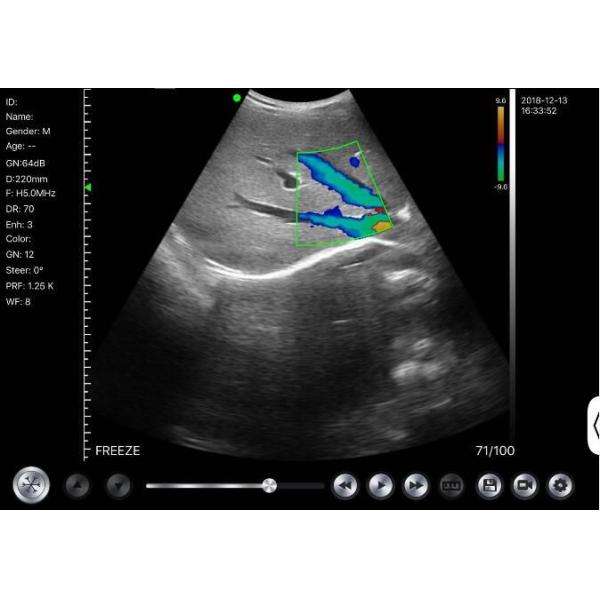 Home Doppler Ultrasound Portable Diagnostic Hand held Doppler Ultrasound Obstetric Gynecology Pediatrics Application