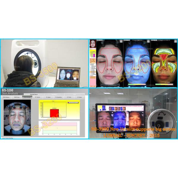 7200 K 3d Epidermal Skin Analysis Machine With English Version Software