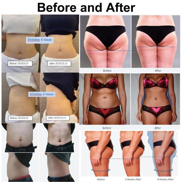 Beauty Vacuum RF Slimming Machine , Standing Cellulite Vacuum Roller Machine