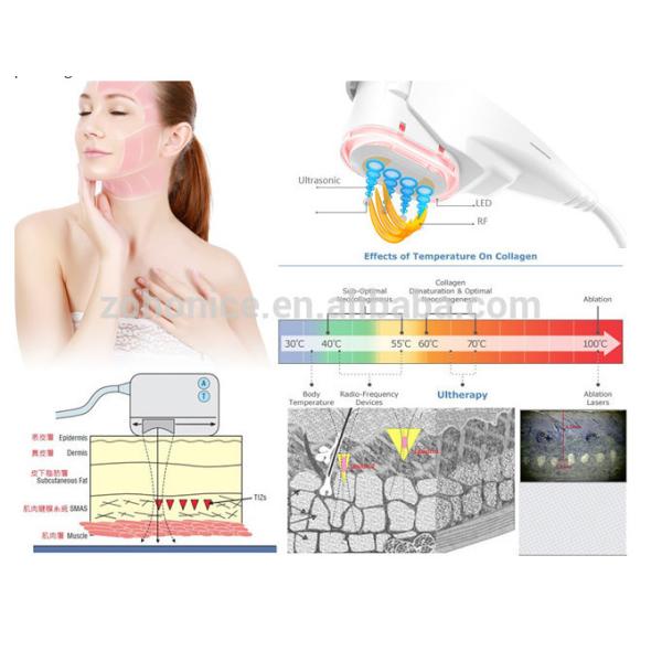 Deep Cleanser High Intensity Focused sound Machine Mini For Anti-aging