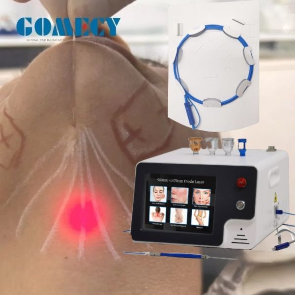 Hot Selling Endolaser Face Lift Laser Body Shaping Lipolysis Equipment 980nm 30w OEM Endolifting Laser Machine