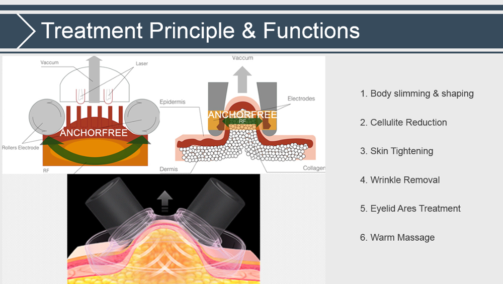 White Lasertell 10MHz Rf Lipo Cavitation Machine Body Figuring