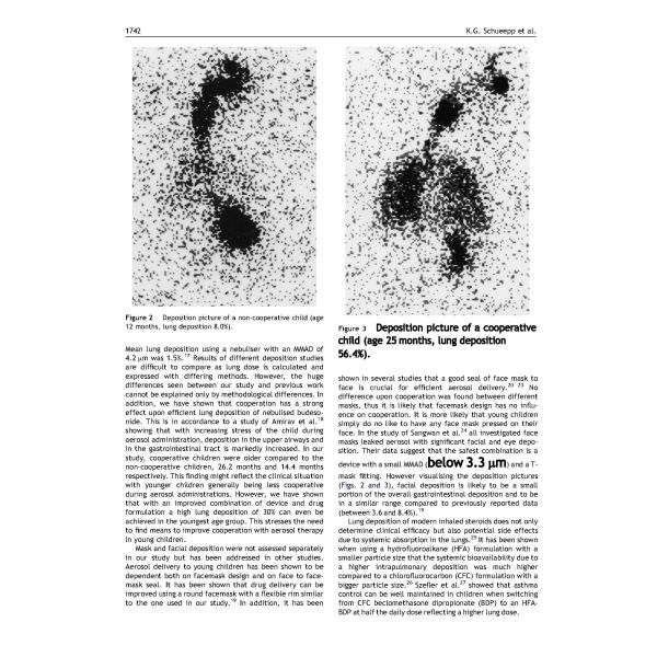 Kids Asthma Nebulizer Machine Portable Removable Battery Bronchus