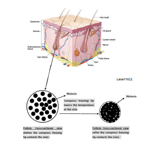Painfree 808nm Diode Laser Hair Removal Machine , Portable Face Rejuvenation Machine