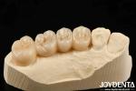 Multilayer Full Zirconia White Style With Layers High Translucency High