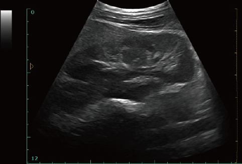 Digital Portable Mobile Laptop Ultrasound Scanner With 12-inch LED Display & 9.7-inch Touch Screen