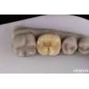 Buy cheap Customizable Zirconia Inlay Onlay Minimal Preparation For Damaged Teeth from wholesalers