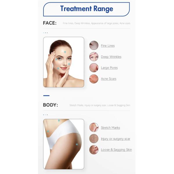 Wrinkle Removal Secret RF Machine