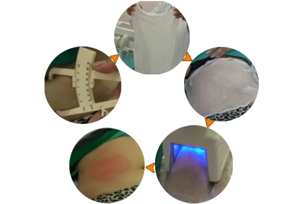 NUBWAY OEM 3 years warranty best result reduce 3-8cm Cryolipolysis Slimming Device