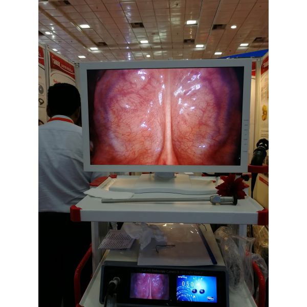 Endoscopy Diagnostic Medical Imaging Equipment Arthroscopy 60HZ ENT Endoscope