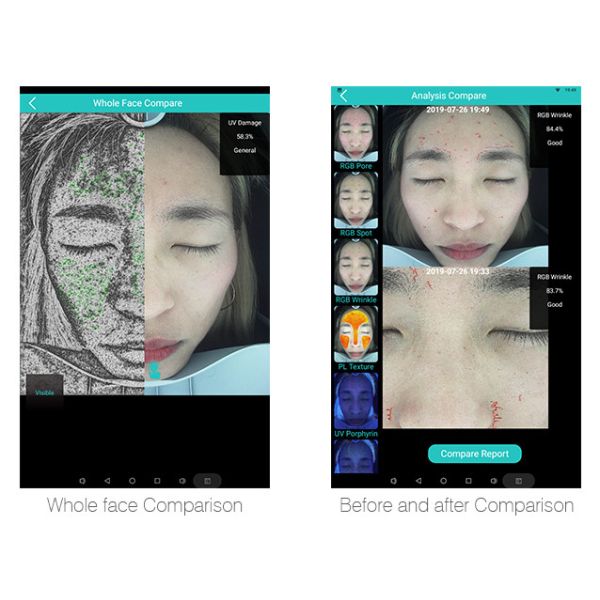 Humanized Design 3d Home Analyzers For Facial Skin 12 Skin Problem Detected