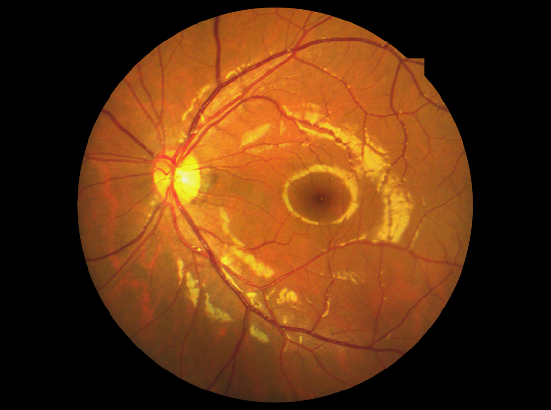 Ophthalmic Non Mydriatic Fundus Camera 50° Field Angle 220V 50 Hz Class I