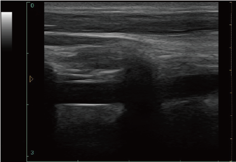 Digital Portable Mobile Laptop Ultrasound Scanner With 12-inch LED Display & 9.7-inch Touch Screen